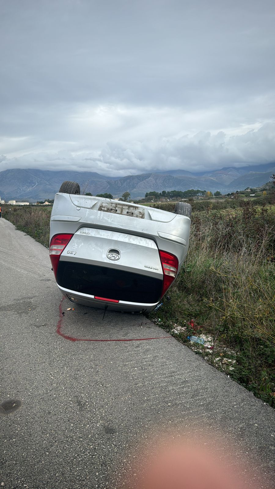 Aksident i rëndë në Sarandë-Delvinë, i riu humb kontrollin e ‘Hyndai’-t, përmbyset makina