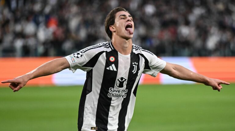 Juventus Yildiz