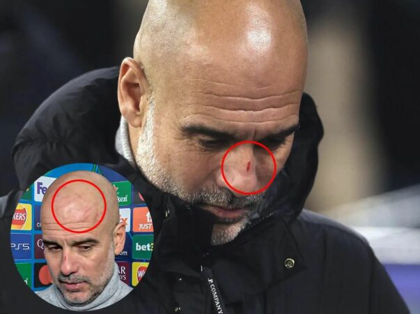 Guardiola