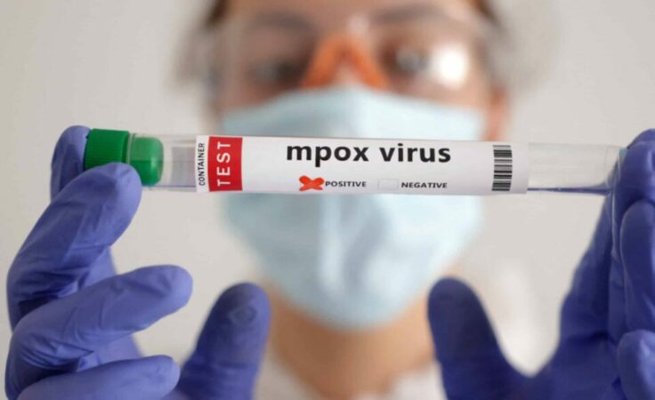 2024 08 22t155357z 2 Lynxmpek7l0ll Rtroptp 4 Health Mpox Scaled E1724372405951 960x587